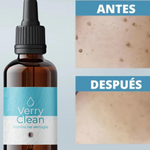 AdiósYa™ VerryClean Elimina Verrugas+ENVIO GRATIS 🚚