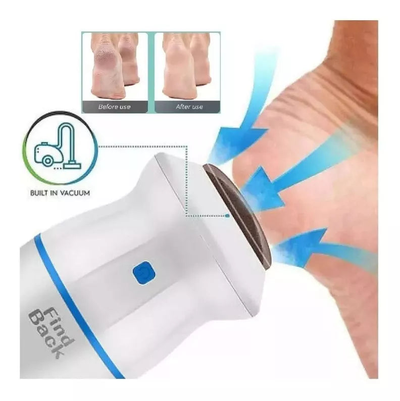 Callobliss™ 😣 ¿Talones agrietados, callos duros y piel seca?