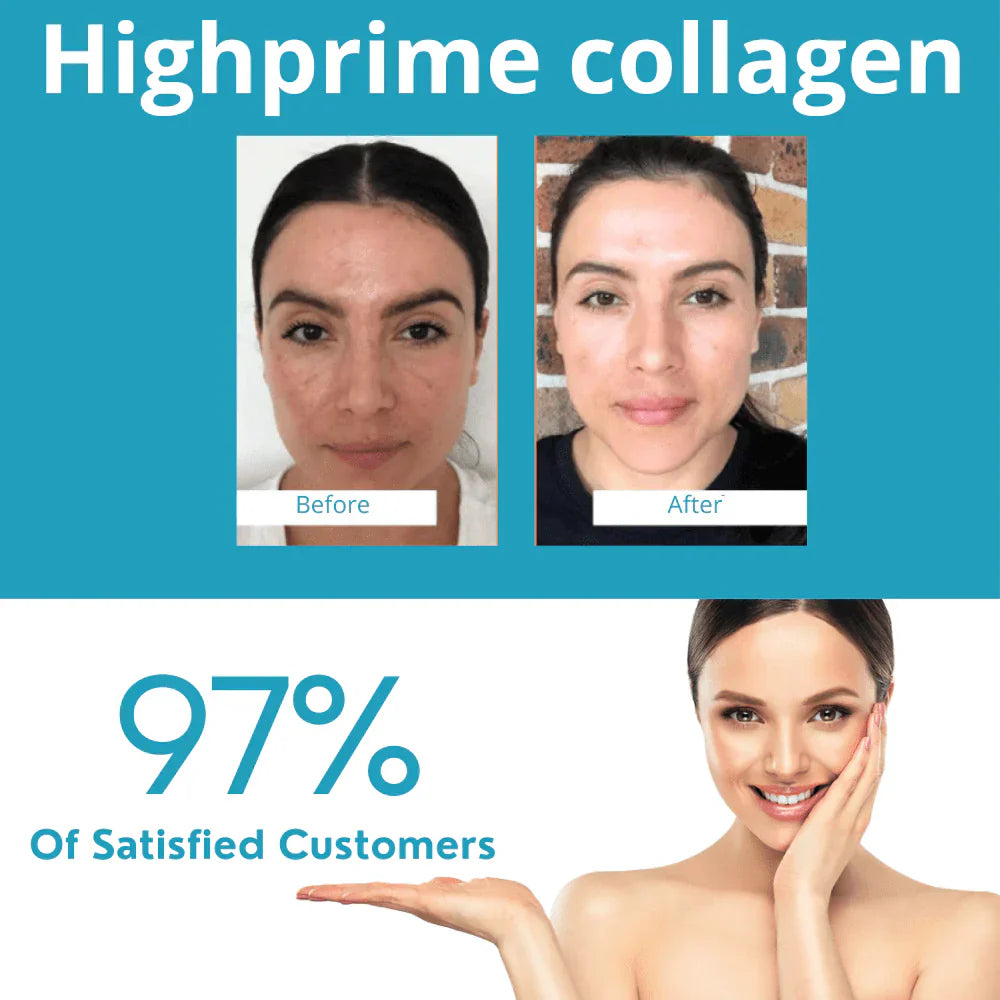 Piel de Seda™ Set de   Mascarillas de colágeno soluble Skin Care Koreano