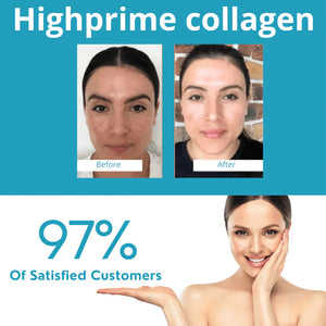 Piel de Seda™ Set de   Mascarillas de colágeno soluble Skin Care Koreano