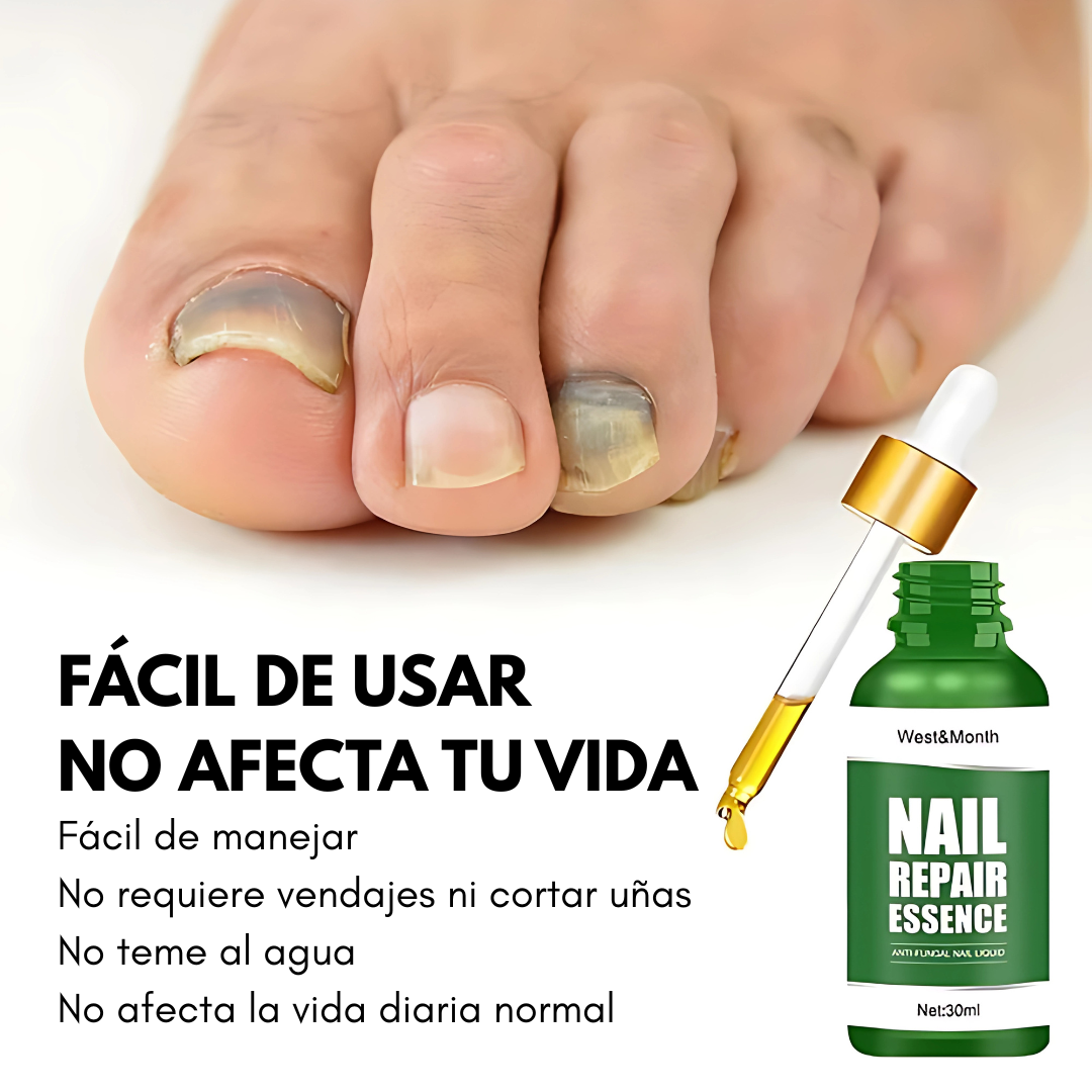 REPARADOR DE UÑAS™ – Fortalece y nutre tus uñas dañadas .