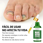 REPARADOR DE UÑAS™ – Fortalece y nutre tus uñas dañadas .
