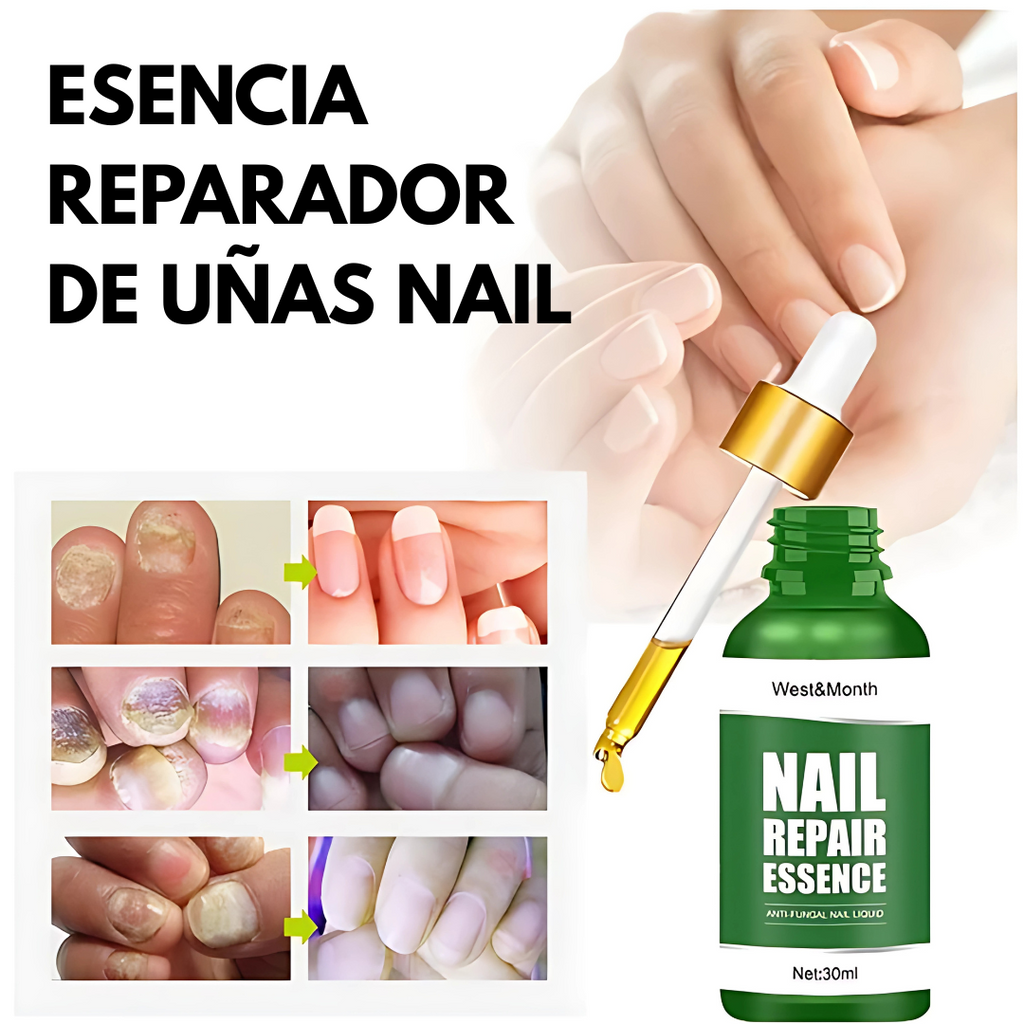 REPARADOR DE UÑAS™ – Fortalece y nutre tus uñas dañadas .