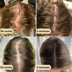 VitalHair™ Serum natural para el crecimiento del cabello