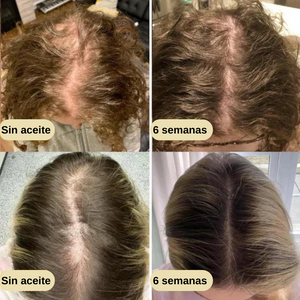 VitalHair™ Serum natural para el crecimiento del cabello