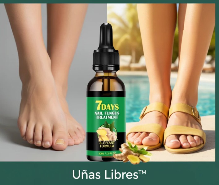 SUERO ANTI HONGOS™  💅✨  “Fuerza y brillo natural para tus uñas. +ENVIO GRATIS 🚚