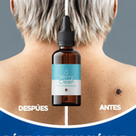 AdiósYa™ VerryClean Elimina Verrugas+ENVIO GRATIS 🚚