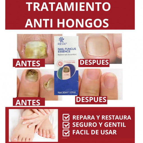 SUERO ANTI HONGOS™  💅✨  “Fuerza y brillo natural para tus uñas. +ENVIO GRATIS 🚚