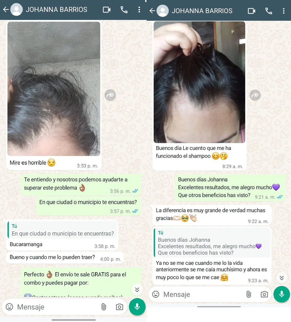 ScalpCare™ Serum anticaspa, control y anticaida