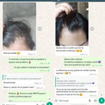 ScalpCare™ Serum anticaspa, control y anticaida