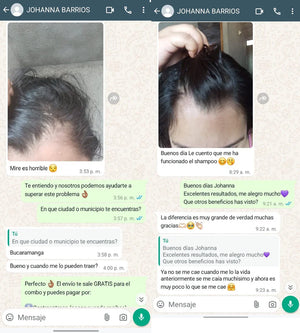 ScalpCare™ Serum anticaspa, control y anticaida
